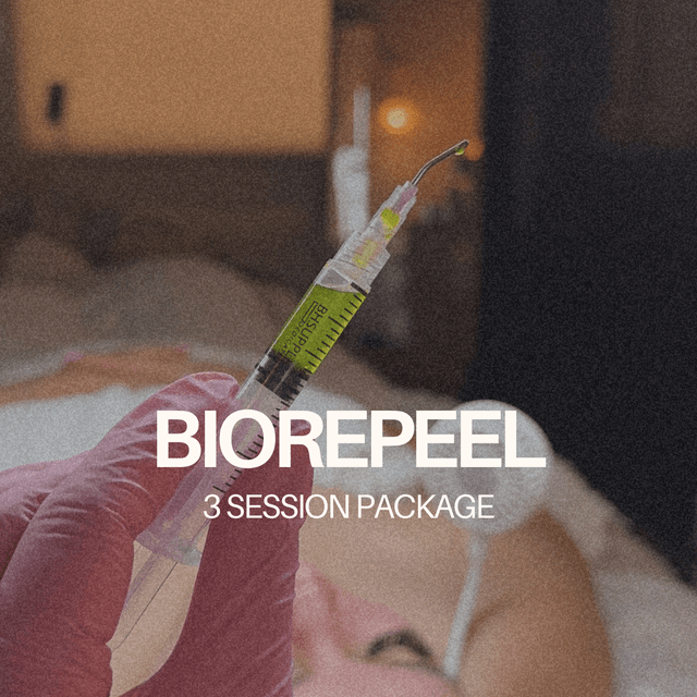 BioRePeel 3 Session Packages